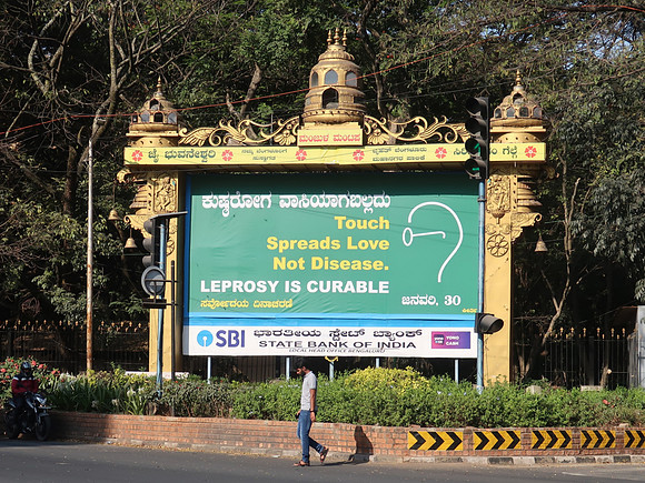 IMG_7467-leprosy-is-curable